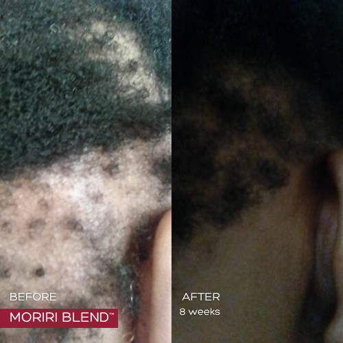 MORIRI BLEND™ - 6 Months Supply